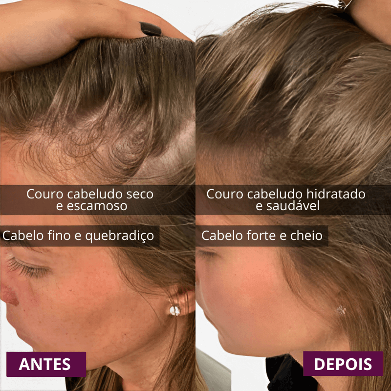 RedGlow - Estimulador Capilar com Led Terapia 3.0