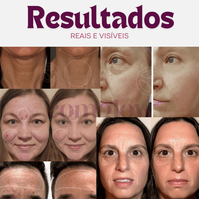 Comglow Skin • Massageador Facial